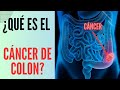 ¿Qué es el cáncer de colon?