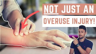 Repetitive Strain Injuries (RSI): Why Overuse Alone Is Not the Cause