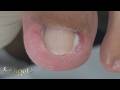 Eu não sabia direito por onde começar de tão pra dentro a unha dele #satisfying #nails