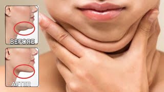 Lose Double Chin & Face Fat in 10 Days - Lose NeckFat | Slim Face Exercise | Double Chin Exercise