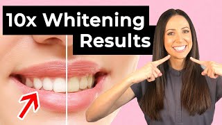 10x Whiter Teeth With This Simple Trick (Dental Hygienist Explains)