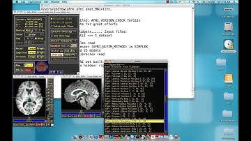 Creating Spherical ROIs in AFNI