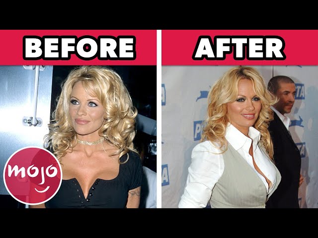Top 20 Celebrities Who Regret Their Plastic Surgery class=