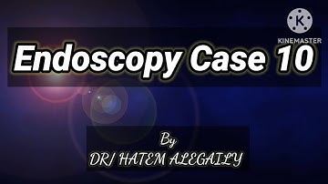 ENDOSCOPY CASE 10https://youtube.com/@medicalsnacks1526