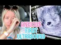 OUR FIRST ULTRASOUND | 5 WEEKS PREGNANT