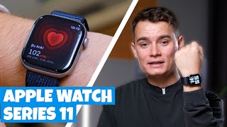 Apple Watch Series 11 Incelemesi