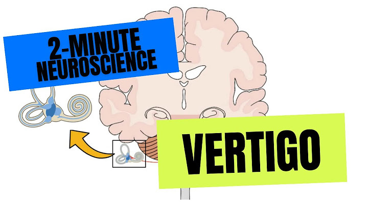 2-Minute Neuroscience: Vertigo