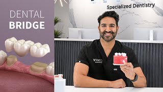 What Is A Dental Bridge?