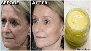 An ingredient, a million times stronger than botox.🌱 apply it on your face, and get rid of wrinkles