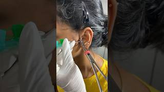 Tragus #piercing #traguspiercing #nosepiercing #lobepiercing #conchpiercing #earpiercing #earpierced Profile