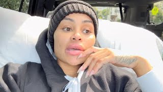 Blac Chyna Says Her Cosmetic Surgeries Didn't Represent Who She Was 'Internally'