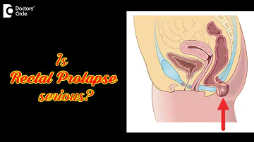 5 Symptoms to recognize Rectal Prolapse: Causes, Treatment - Dr. Rajasekhar M R | Doctors' Circle