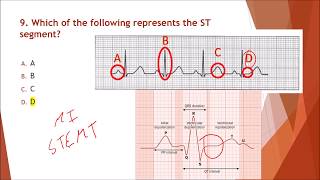 NHA Module 13 EKG and Cardiovascular Testing  Q&A