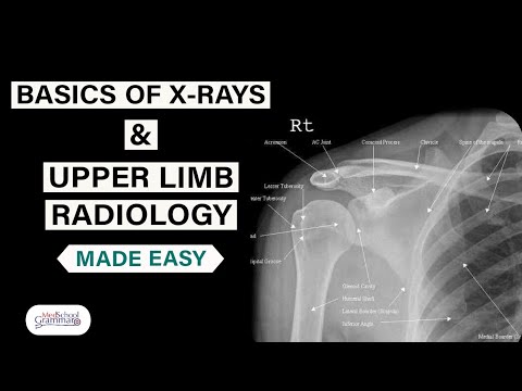 Radiological Anatomy Made Easy| Basics of X-Rays and Upper Limb Radiology