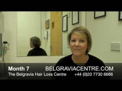 Women's Hair Loss - Video Diary month 7