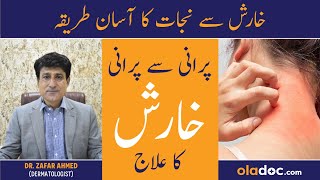 Kharish Khatam Karne Ka Tarika - Scabies Ka Ilaj In Urdu - Itching Treatment - Kharish Ka Fori Ilaj
