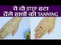 How to Remove Hand Tanning DIY: इन दो Steps से दूर हो जाएगी हाथों की टैनिंग | Boldsky