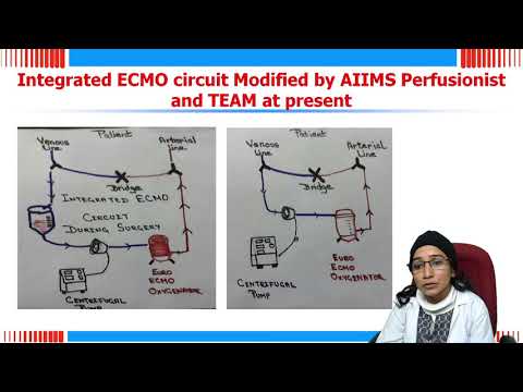 Video: Low-Flow-Bewertung Der Aktuellen ECMO / ECCO 2 R-Rotationsblutpumpen Und Mögliche Auswirkungen Auf Die Hämokompatibilität