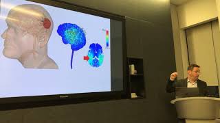 Transcranial Direct Current Stimulation (tDCS) Dose Response: Lecture by Marom Bikson
