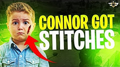 connor got stitches first games of season 7 fortnite battle royale duration 14 57 - connor fortnite face reveal