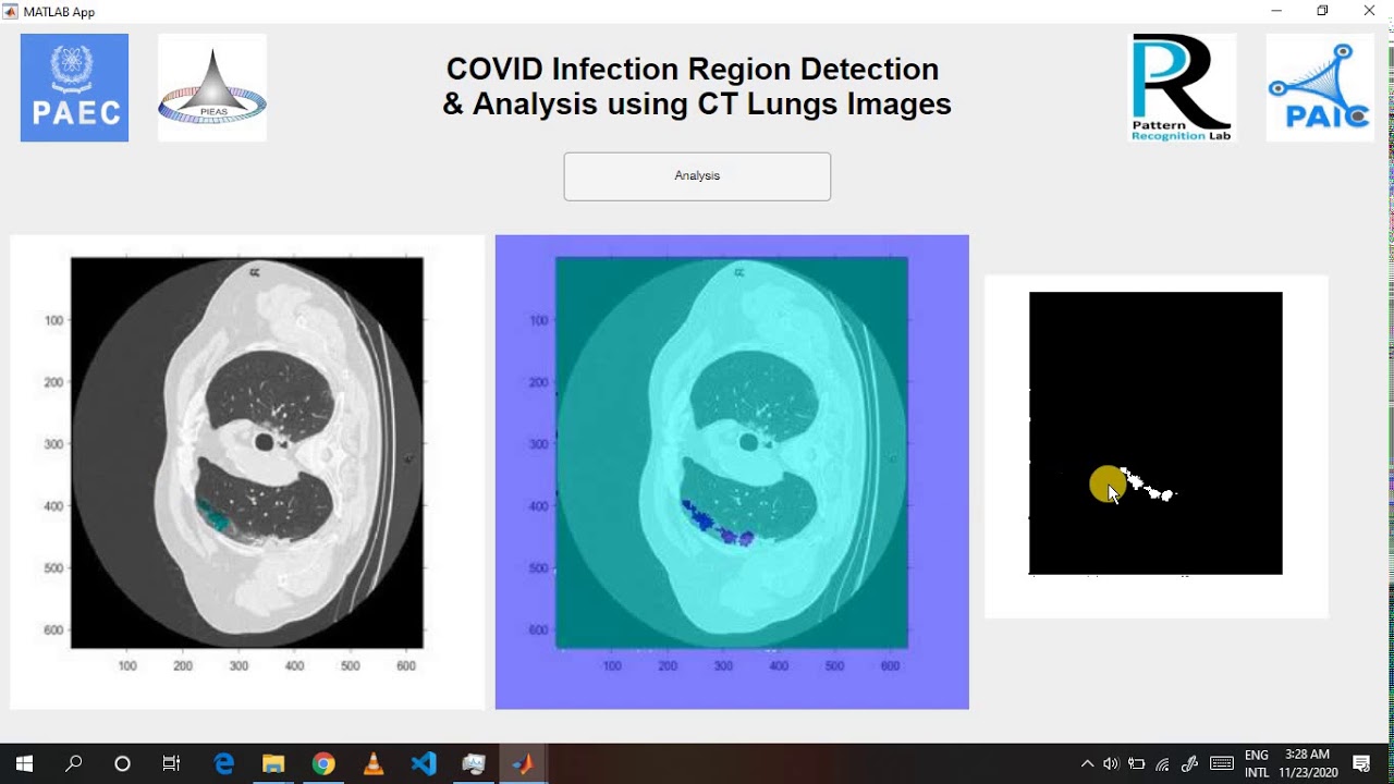 COVID-19 Diagnostic System using CT Lungs Images and Deep Learning ...