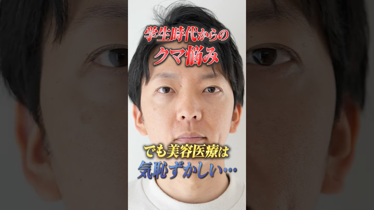 かっこいいパパになりたい・・・40代男性の初めてのクマ取りに密着!#shorts #クマ取り #クマ取整形 #目の下のクマ #クマ診断 #クマ取りナビ #裏ハムラ