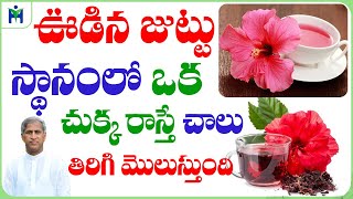 Easy Ways To Reverse Hair Loss & Promote Hair Growth | Mandaram | Dr Manthena Satyanarayana Raju