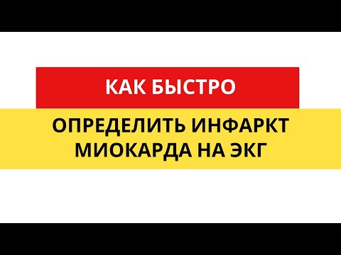 Video: Башкалар билимде эмнени билдирет?