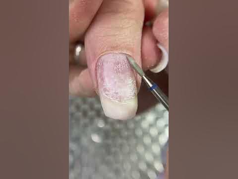 🦠Синегнойка🦠 или что может быть под отслойкой😵‍💫 #мастерманикюра # ...
