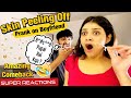 Skin Peeling Off | Prank on Boyfriend | Amazing Comeback