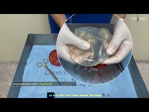 EXPLANT August 19th 2022 2 19 De Agosto 2022 2