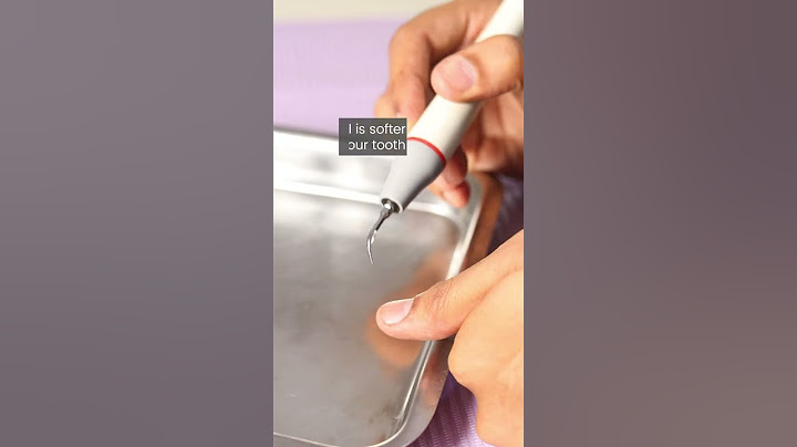 Does Scaling Harm Your Teeth 🦷 ? | Chopra Dental Care, Nungambakkam | Dr. Pankaj Chopra
