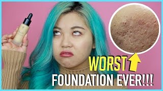 Worst Foundation Ever For Acne Skin Be Aware
