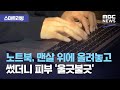 [스마트리빙] 노트북, 맨살 위에 올려놓고 썼더니 피부 '울긋불긋' (2020.09.24/뉴스투데이/MBC)