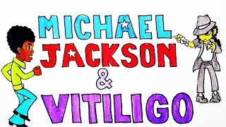 Michael Jackson Y Su Cambio De Color De Piel