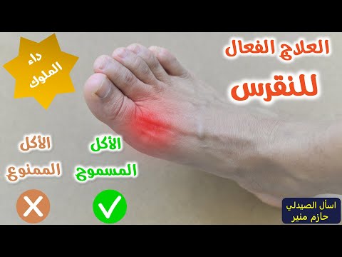 افضل واسوأ الاطعمة لمريض النقرس علاج النقرس من الألف إلى الياء