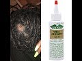 WILD GROWTH HAIR OIL: DOES IT REALLY WORK?! (PICS INCLUDED)