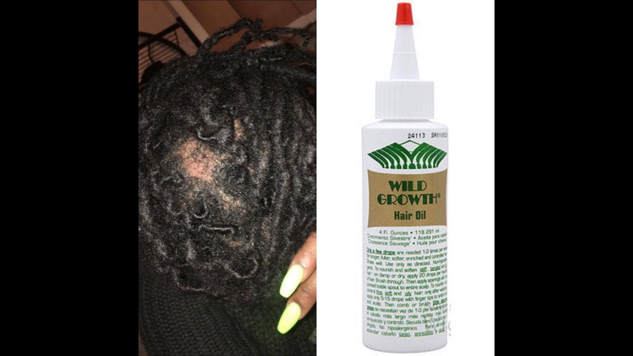 Wild Growth Hair Oil Does It Really Work Pics Included Youtube