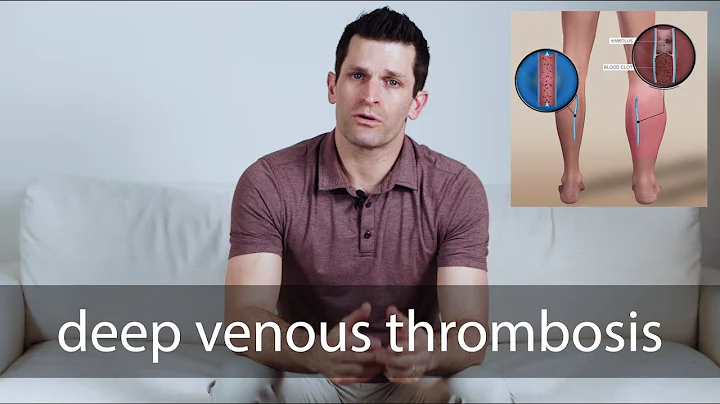 deep venous thrombosis - DayDayNews