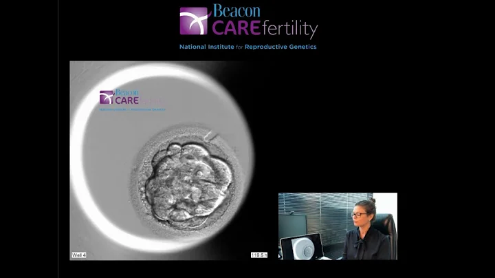 Explanation: Embryo Stages of Development from Day 1 to Day 5 (Blastocyst)-Beacon CARE Fertility