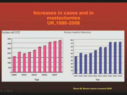 Breast screening: some inconvenient truths (28 Oct...