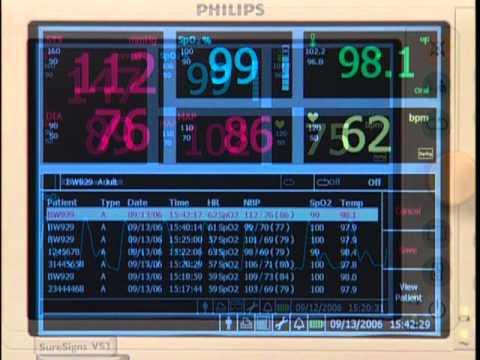 How to Read A Vital Signs Monitor 