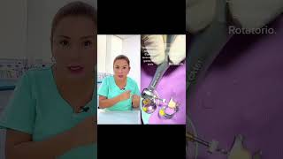 Conoce Más De La Endodoncia Rotatoria.