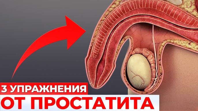 Әйелдердің еркектерді ұрып жатқан порнографиялық суреттері Әйеліңіздің кискасын қалай созуға болады