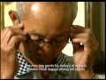 Gaa** kaseryoso Glaucoma?