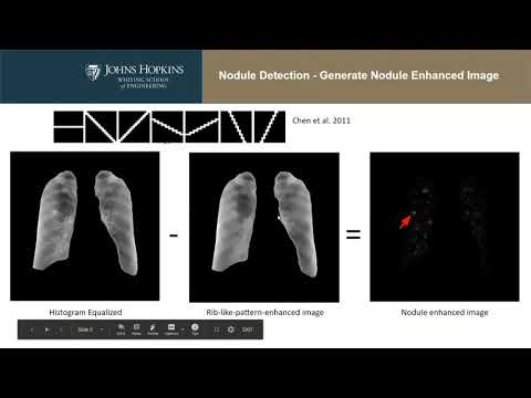 Chest X-ray segmentation and lung nodule detection