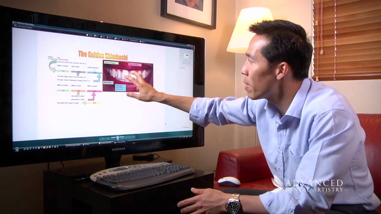 Advanced Dental Artistry balanced smile from worn down teeth Perth Cosmetic and Dental Implant Team