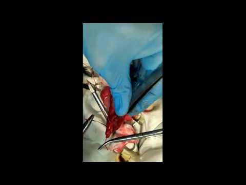 Гастротомия.  Инородное тело извлеченное из желудка кота