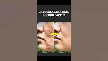 How Adobe Photoshop | Clear Skin in 1 Minute – Easy Retouching for Beginners