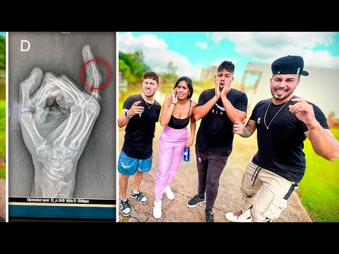 ELES PENSARAM QUE ERA TROLAGEM - QUEBREI O DEDO MEUS AMIGOS